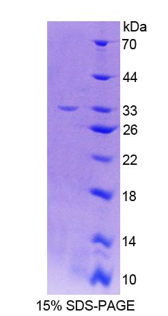 Recombinant Thymocyte Nuclear Protein 1 (THYN1)