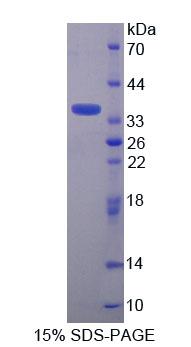 Recombinant Trinucleotide Repeat Containing Protein 6A (TNRC6A)