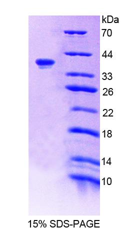 Recombinant Tensin 1 (TNS1)