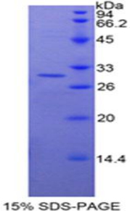 Recombinant Toll Interacting Protein (TOLLIP)