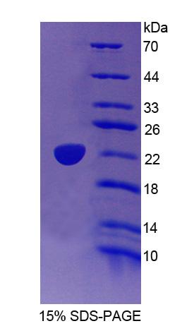 Recombinant Transcriptional Regulating Factor 1 (TRERF1)