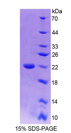Recombinant Transcriptional Regulating Factor 1 (TRERF1)