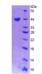 Recombinant Three Prime Repair Exonuclease 1 (TREX1)