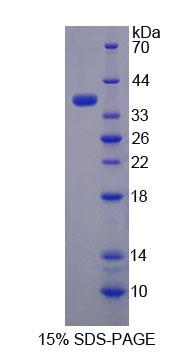 Recombinant Thiosulfate Sulfurtransferase (TST)