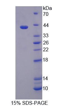 Recombinant Tissue Specific Transplantation Antigen P35B (TSTA3)