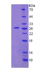 Recombinant Thiopurine Methyltransferase (TPMT)