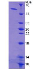 Recombinant Thymidine Kinase 1, Soluble (TK1)