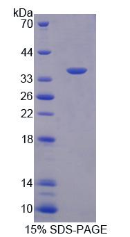Recombinant Syntenin 1 (ST1)