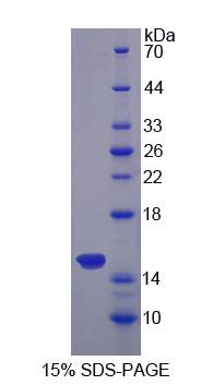 Recombinant Sideroflexin 1 (SFXN1)