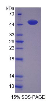 Recombinant Renalase (RNLS)