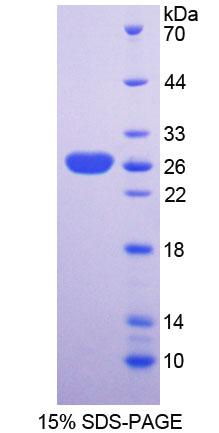 Recombinant Sorting Nexin Associated Golgi Protein 1 (SNAG1)