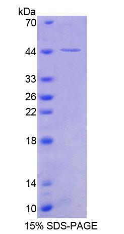 Recombinant Snurportin 1 (SNUPN1)