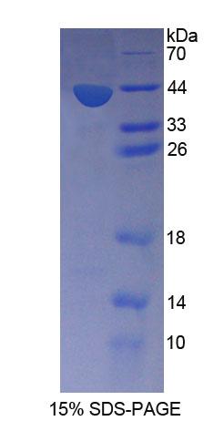 Recombinant Snurportin 1 (SNUPN1)