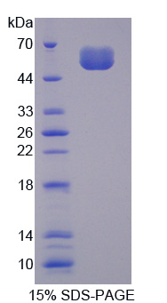 Recombinant Sclerostin (SOST)