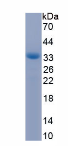 Recombinant Sterol Regulatory Element Binding Transcription Factor 1 (SREBF1)