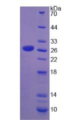 Recombinant Sterol Regulatory Element Binding Transcription Factor 1 (SREBF1)