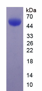 Recombinant Stanniocalcin 1 (STC1)