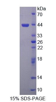 Recombinant Symplekin (SYMPK)