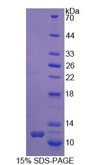 Recombinant Symplekin (SYMPK)