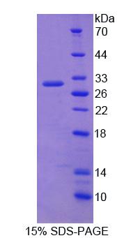 Recombinant Chromogranin B (CHGB)