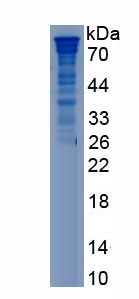 Recombinant Chromogranin B (CHGB)