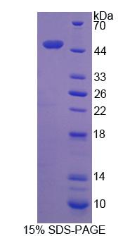 Recombinant Dynactin 2 (DCTN2)