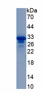 Recombinant Death Inducer Obliterator 1 (DIDO1)