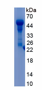 Recombinant Dual Specificity Phosphatase 1 (DUSP1)