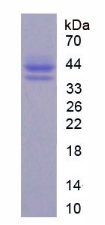 Recombinant Glutamate Decarboxylase 1, Brain (GAD1)