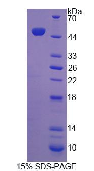 Recombinant Reticulon 1 (RTN1)