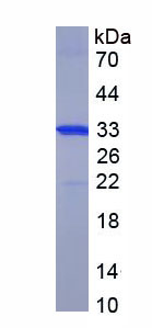 Recombinant Fibroblast Growth Factor 3 (FGF3)