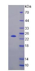 Recombinant Fibroblast Growth Factor 21 (FGF21)