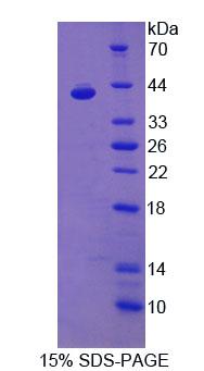 Recombinant Platelet Derived Growth Factor C (PDGFC)