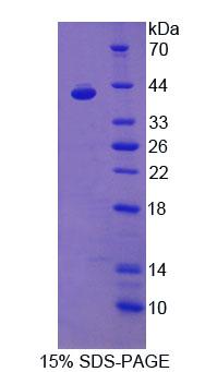 Recombinant Platelet Derived Growth Factor C (PDGFC)