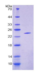 Recombinant Crystallin Alpha B (CRYaB)