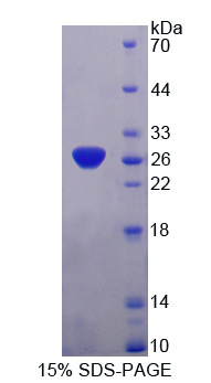 Recombinant Synaptosomal Associated Protein 25kDa (SNAP25)