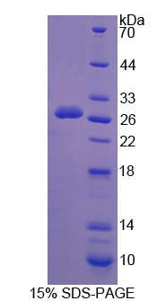 Recombinant Calpain 3 (CAPN3)