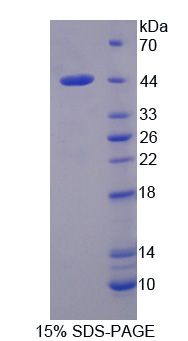 Recombinant Calpain 10 (CAPN10)