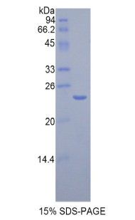 Recombinant Cathepsin B (CTSB)