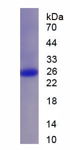 Recombinant Cathepsin C (CTSC)