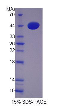 Recombinant Cathepsin W (CTSW)