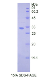 Recombinant Cathepsin V (CTSV)