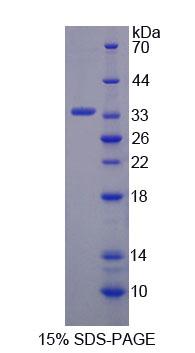 Recombinant Microtubule Associated Protein 1B (MAP1B)