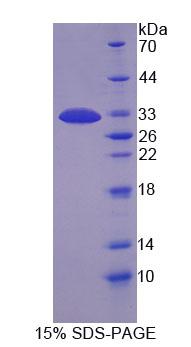 Recombinant Microtubule Associated Protein 1B (MAP1B)
