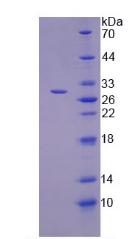 Recombinant Tankyrase 2 (TNKS2)