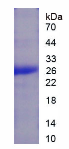 Recombinant Glutathione Peroxidase 3, Plasma (GPX3)