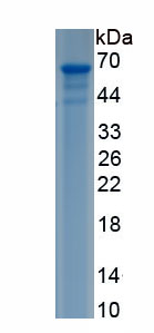 Recombinant Asparaginyl tRNA Synthetase (NARS)