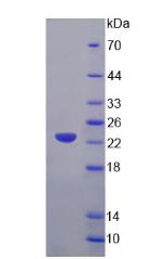 Recombinant Glycyl tRNA Synthetase (GARS)