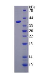 Recombinant Histidyl tRNA Synthetase (HARS)