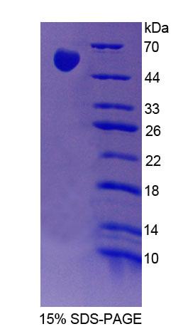 Recombinant Phenylalanyl tRNA Synthetase 2, Mitochondrial (FARS2)